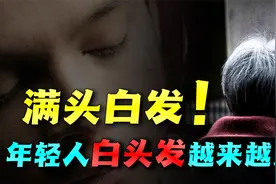 为何年轻人白头发越来越多？是什么原因？又该如何解决？视频封面