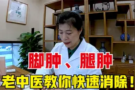 经常腿肿、脚肿、下肢水肿，是哪出了问题，老中医教你快速消除！视频封面