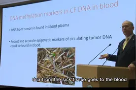 摩西·西夫院士在中日友好医院座谈-DNA甲基化应用于癌症早筛检测视频封面
