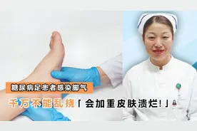 糖尿病足患者，感染脚气，千万不能乱挠，会加重皮肤溃烂坏死！视频封面