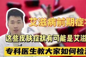皮肤出现这几种情况，可能是艾滋病！别当成皮肤病耽误了视频封面
