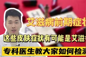 皮肤出现这几种情况，可能是艾滋病！别当成皮肤病耽误了视频封面