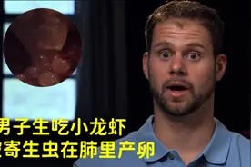 男子生吃小龙虾，竟被寄生虫啃食肺部，并产卵！！！视频封面