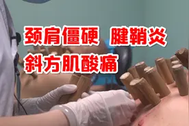 颈肩僵硬、两侧斜方肌酸痛、腱鞘炎，御医良方，逐渐好转视频封面