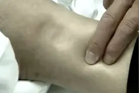 男子肚子大得像孕妇，全身多脏器衰竭，介入手术步步惊心视频封面