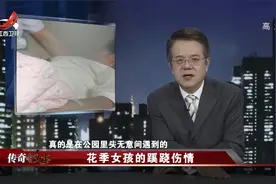 传奇故事：手上出现俩红点，医院查不出原因，当晚病情恶化去世视频封面