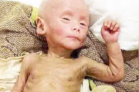 5岁男孩变老头，竟因为老人每天给他喝的这个，家长还给孩子喝吗视频封面