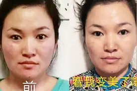 颧骨高、大小脸、牙齿整排偏斜、下巴偏斜、看用正骨手法怎么矫正视频封面