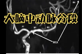 大脑中动脉分段、MRA、CTA下大脑中动脉解剖分段--（吴老师专讲）视频封面