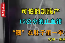 剖宫产后腰疼1年多，体内藏止血钳，一位医生提醒：产后42天复查视频封面