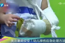 儿童骨科日接诊300例患儿！医生教你摔伤后如何应急处理视频封面