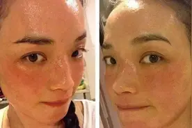 舒淇饱受过敏困扰？为养病停工数月，网友猜测：生儿育女恐无期？视频封面