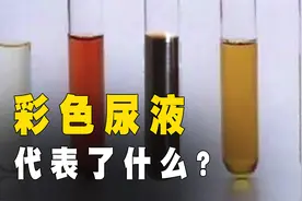 水喝多尿液是无色的，不同颜色反映不同情况，你的身体还好吗？视频封面