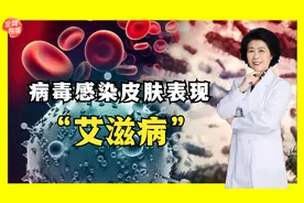 皮肤溃烂可别不当回事，当心是感染了艾滋病，耽误病情治疗！视频封面