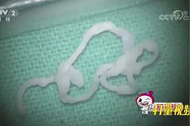 小伙脑部爬进寄生虫，医生手术3小时，终于将虫取出|职场健康课视频封面
