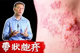 修复带状疱疹的自然疗法,柏格医生 Dr Berg视频封面