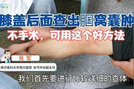膝盖后面长肿包，腘窝囊肿该怎么治？医生教您不用手术的好方法视频封面