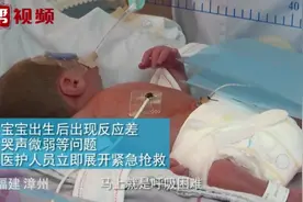 仅巴掌大！出生900克的男婴奇迹存活