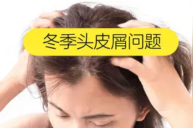 为什么冬天的头皮屑是最多的视频封面