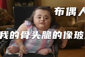 长不大的“布偶娃娃”？ 什么是“脆骨病”？视频封面