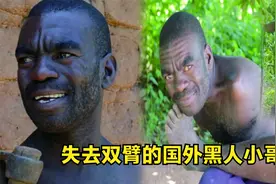 失去双臂的国外黑人小哥， 积极乐观态度面对生活，值得我们学习视频封面