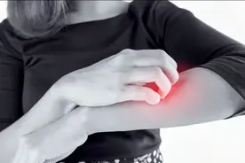 湿疹、皮肤瘙痒用皮炎平还是达克宁？功效侧重不同，医生解答视频封面