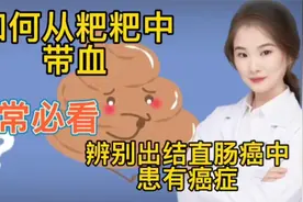 医学探究 如何从带血的粑粑中 辨别出是否结直肠癌患有癌症的可能视频封面