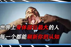 身体部位最大的人，个个都刷新人类极限，第一名简直让人细思极恐视频封面