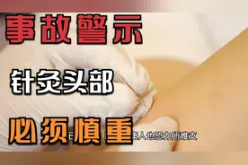 实例 精神分裂男子因针灸头部而死亡视频封面