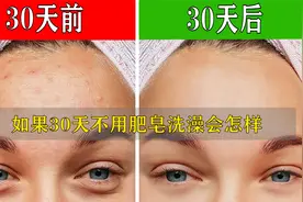 如果我们连续30天洗澡不用肥皂会怎么样？变化将会超出你想象视频封面