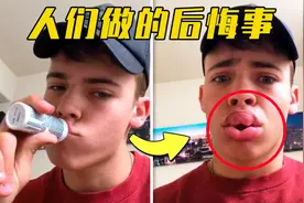 6件人们做的后悔事，用瓶子做性感丰唇，结果肿成香肠！视频封面