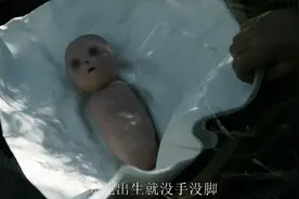 婴儿天生没有手脚，父母竟把他抛弃！视频封面