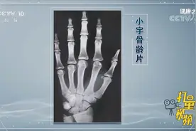 骨头年龄和时间年龄之间，差一岁到一岁半属于正常现象|健康之路视频封面