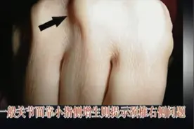 手掌面哪个区域有问题，对应自己的脏腑自检，手背也有定位视频封面