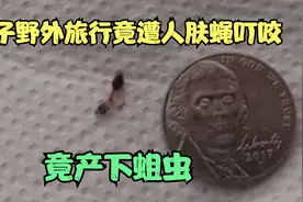 男子野外旅行，竟遭人肤蝇钻进腿产卵！视频封面