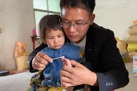 优优脚趾头起皮越来越严重，到底是啥原因？医生开300多的药视频封面