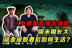 寇金成：3岁被狼咬掉半张脸，吸米糊长大，娶妻生子后越过越好视频封面