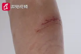贵阳黔灵山的“泼猴”又双叕惹祸了！这次是四岁女童被抓伤视频封面