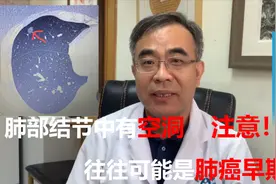 肺部结节有空洞，往往预示着可能是早期肺癌，需提高警惕！视频封面