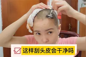 自己在家操作刮头皮,这样热敷,你们觉得能把这个头皮刮干净吗