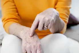 脸上长老年斑，是体内毒素过多还是免疫力低下？中医给出答案视频封面