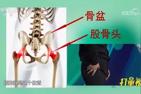 股骨头究竟在哪，它的作用是什么？专家进行讲解|职场健康课