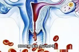 下身肥大是什么原因导致？是否需要治疗？女性早了解早受益视频封面