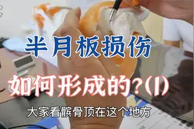 半月板损伤是如何形成的？该怎么避免？肖教授阅片讲解（1）
