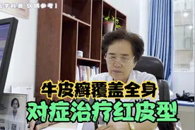 男子牛皮癣爆发全身，已形成红皮型，用药须谨慎视频封面