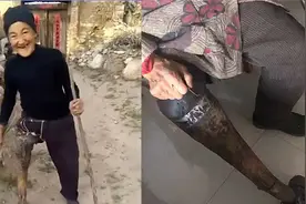 全网寻找的“马腿奶奶”找到了：家中条件不错 用惯旧假肢不愿换视频封面