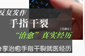 分享治愈手指干裂就医经历（石家庄）视频封面