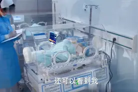 妇产科：连体婴做分离手术，最后只活下一个，妈妈表现让人痛心！视频封面