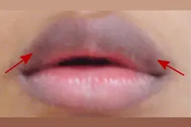 如何通过嘴唇判断健康状况？医生：颜色发黑发暗，谨防这2类疾病视频封面