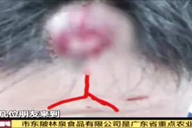 深圳：女子醉酒坐错桌，同伴去解围却遭到殴打，两人被打成重伤视频封面